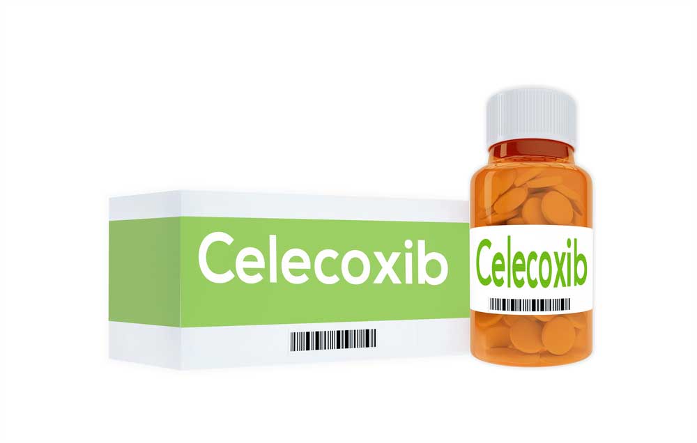 Celecoxib thường được kết hợp giúp điều trị xương khớp