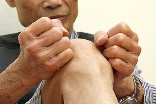 Khô khớp gối khiến người bệnh khổ sở
