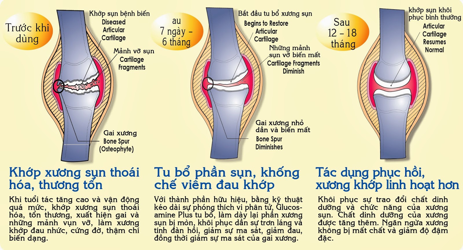 Sau khi sử dụng Orihiro Glucosamine cải thiện sức khỏe xương khớp hiệu quả