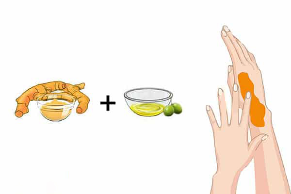 Nghệ là một nguyên liệu giúp giảm đau khớp tay hiệu quả
