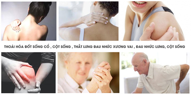 Glucosamine mang đến những tác động chăm sóc sức khỏe xương khớp