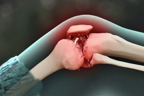 Tràn dịch khối khớp là một căn bệnh khá nguy hiểm