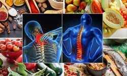 Thoái hóa đốt sống lưng nên ăn gì để mau lành bệnh Thoái hóa đốt sống lưng nên ăn gì để mau lành bệnh