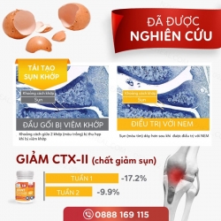 Viên uống bổ khớp 3X Joint Defense Deep Blue Health
