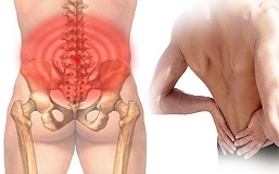 Đau xương sống vùng thắt lưng liên quan đến bệnh lý gì?